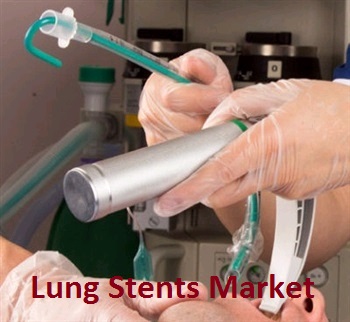 Airway Stent/Lung Stent Market