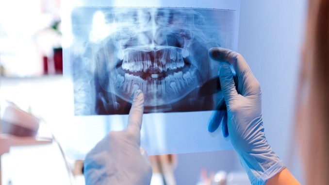 Dental Radiography Market