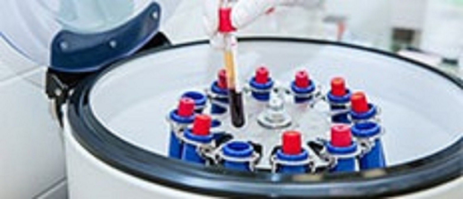 Slide Stainer Market