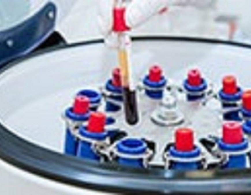 Slide Stainer Market