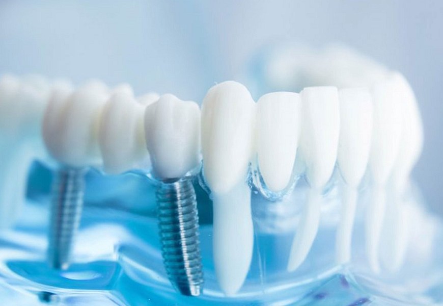 Dental Biomaterials Market