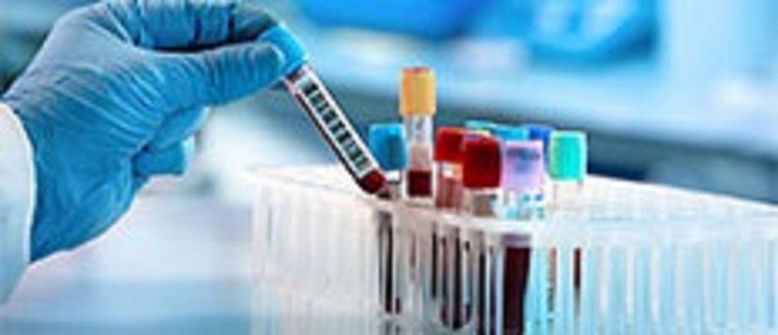 Influenza Diagnostics Market