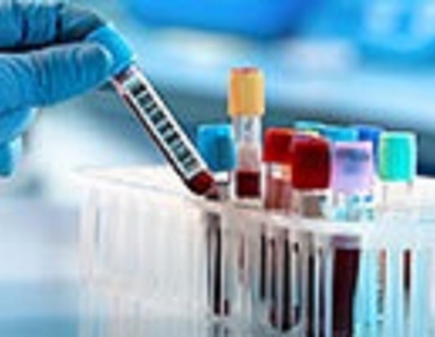 Influenza Diagnostics Market