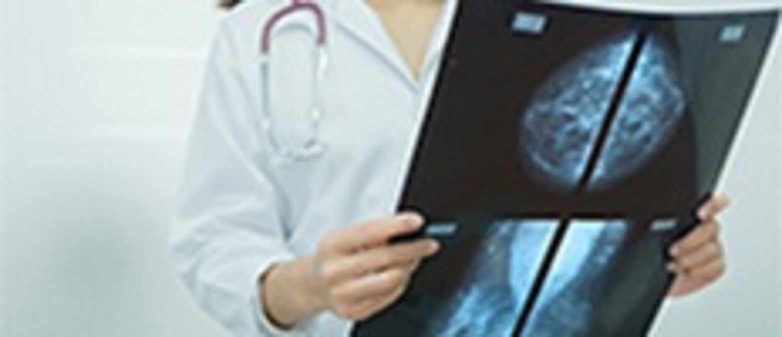 Breast Lesion Localization Methods Market