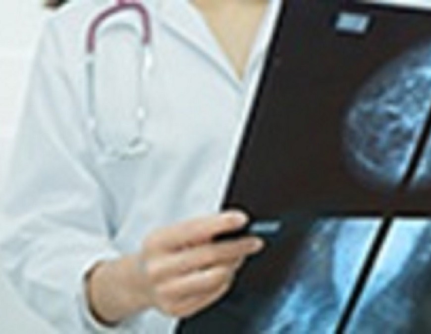 Breast Lesion Localization Methods Market