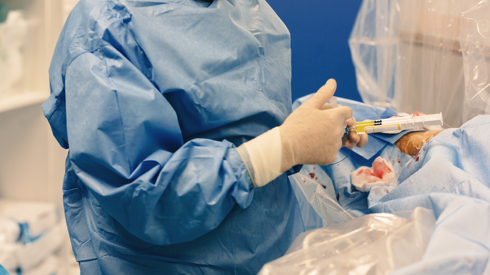 Embolotherapy Market