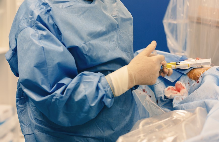 Embolotherapy Market