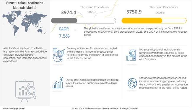 Breast Lesion Localization Methods Market