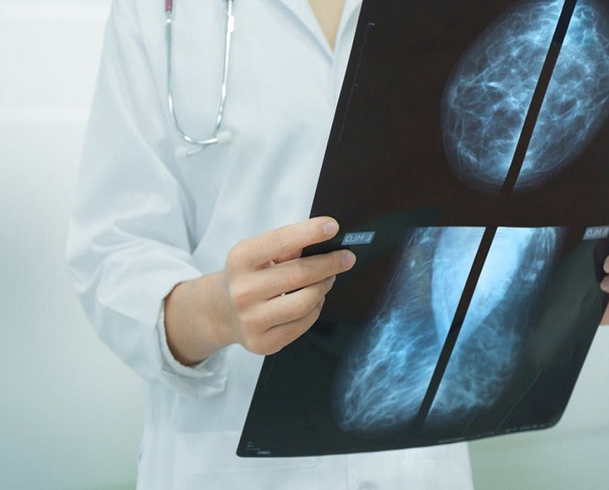 Breast Imaging Market