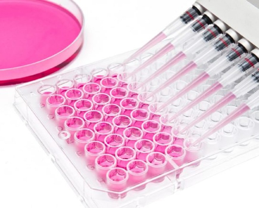 COVID 19 Impact on IVD (In Vitro Diagnostics) Market